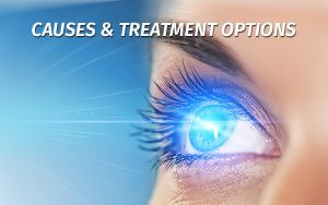 Astigmatism Causes & Treatment Options - Grosinger, Spigelman & Grey